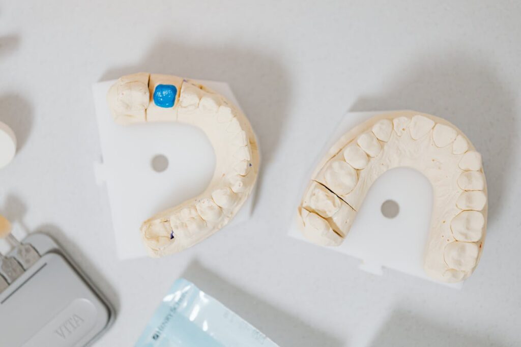 Faccette dentali personalizzate Salerno